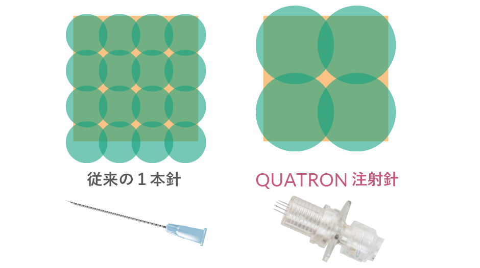 薬液の送達